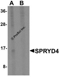 Western blot analysis of SPRYD4 in mouse kidney tissue lysate with SPRYD4 antibody at 1 &#956;g/mL in (A) the absence and (B) the presence of blocking peptide.