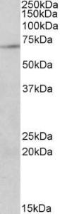 Anti-PRMT5 Antibody (A83003) staining (2µg/ml) of Jurkat lysate (RIPA buffer, 35µg total protein per lane). Primary incubated for 1 hour. Detected by western blot using chemiluminescence.