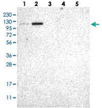 Anti-AASS Rabbit Polyclonal Antibody