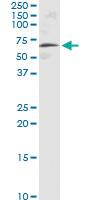 Anti-ASNS Polyclonal Antibody Pair