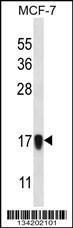 Anti-NDUFA13 Rabbit Polyclonal Antibody