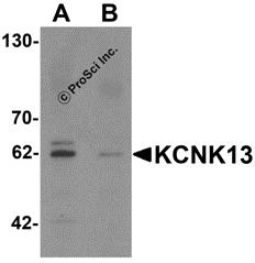 Western blot analysis of KCNK13 in rat brain tissue lysate with KCNK13 antibody at 0.5 &#956;g/mL in (A) the absence and (B) the presence of blocking peptide.