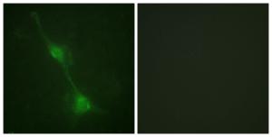 Immunofluorescence analysis of NIH/3T3 cells using Anti-Ataxin 1 Antibody. The right hand panel represents a negative control, where the antibody was pre-incubated with the immunising peptide.