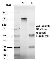 SDS-PAGE analysis of Anti-EIF4A2 Antibody [PCRP-EIF4A2-2B5] under non-reduced and reduced conditions; showing intact IgG and intact heavy and light chains, respectively. SDS-PAGE analysis confirms the integrity and purity of the antibody.