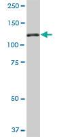 Anti-NEK9 Mouse Monoclonal Antibody [clone: 1F6]