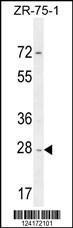 Anti-NDUFAF1 Rabbit Polyclonal Antibody (AP (Alkaline Phosphatase))