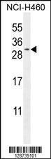 Anti-TEX37 Rabbit Polyclonal Antibody (HRP (Horseradish Peroxidase))