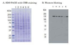 Anti-KDM5A Antibod