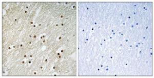 Immunohistochemical analysis of paraffin-embedded human brain tissue using Anti-Ku70 Antibody. The right hand panel represents a negative control, where the antibody was pre-incubated with the immunising peptide