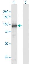 Anti-KDM2A Mouse Polyclonal Antibody