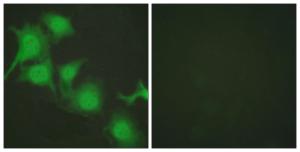 Immunofluorescence analysis of HUVEC cells using Anti-Nrf2 Antibody. The right hand panel represents a negative control, where the antibody was pre-incubated with the immunising peptide.