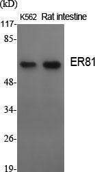 Western blot analysis of various cells using Anti-ER81 Antibody