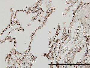 Anti-MEF2A Mouse Monoclonal Antibody [clone: 1A10]