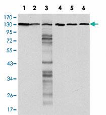 Anti-CDH1 Mouse Monoclonal Antibody [clone: 7A2]