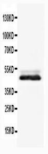 Anti-NSE Rabbit Polyclonal Antibody