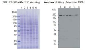 Anti-KDM5A Antibody