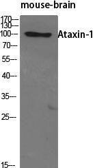 Western blot analysis of various cells using Anti-Ataxin 1 Antibody