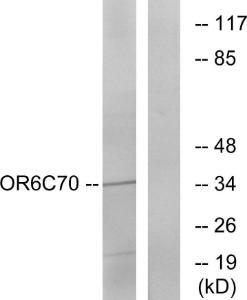 Western blot analysis of lysates from Jurkat cells using Anti-OR6C70 Antibody. The right hand lane represents a negative control, where the antibody is blocked by the immunising peptide