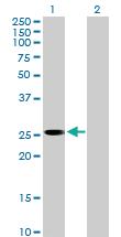 Anti-PLBD1 Mouse Polyclonal Antibody