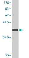 Anti-ARHGEF11 Mouse Monoclonal Antibody [clone: 2H7]