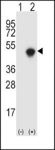 Anti-SPHK1 Rabbit Polyclonal Antibody