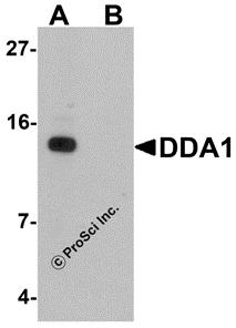 Western blot analysis of DDA1 in mouse heart tissue lysate with DDA1 antibody at 1 &#956;g/mL in (A) the absence and (B) the presence of blocking peptide.