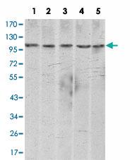 Anti-CDH2 Mouse Monoclonal Antibody [clone: 5D5]