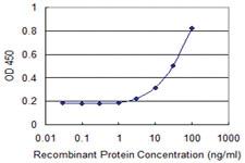 Anti-RAB7L1 Mouse Monoclonal Antibody [clone: 1B10]