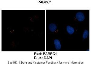 Anti-PABPC1 Rabbit Polyclonal Antibody