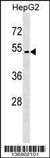 Anti-GPR171 Rabbit Polyclonal Antibody (HRP (Horseradish Peroxidase))