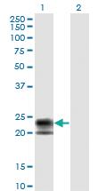 Anti-TNFRSF17 Mouse Monoclonal Antibody [clone: 1F10]