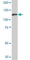 Anti-NEK9 Mouse Monoclonal Antibody [clone: 1F6]