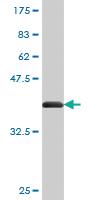 Anti-CENPJ Mouse Monoclonal Antibody [clone: 1A5]