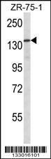 Anti-ATAD2 Rabbit Polyclonal Antibody (AP (Alkaline Phosphatase))