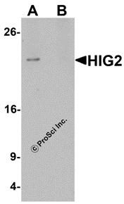 Western blot analysis of HIG2 in 3T3 cell lysate with HIG2 antibody at 1 &#956;g/mL in (A) the absence and (B) the presence of blocking peptide.