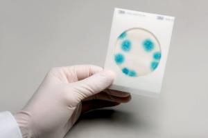 3M™ Petrifilm™ rapid yeast and mould count plates mold