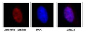 Anti-KDM5A Antibody