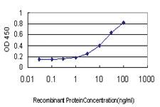 Anti-TNFRSF17 Mouse Monoclonal Antibody [clone: 1F10]