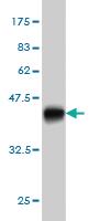 Anti-B4GALNT1 Mouse Monoclonal Antibody [clone: 5F9]