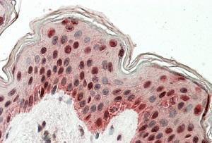 Anti-TIAL1 Antibody (A83006) (3.8 µg/ml) staining of paraffin embedded Human Skin. Steamed antigen retrieval with citrate buffer pH 6, AP-staining