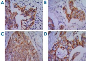 Anti-CDH2 Mouse Monoclonal Antibody [clone: 5D5]