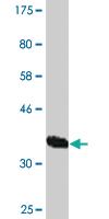 Anti-VPS18 Mouse Monoclonal Antibody [clone: 2G10]