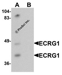 Western blot analysis of ECRG1 in mouse liver tissue lysate with ECRG1 antibody at 1 &#956;g/mL in (A) the absence and (B) the presence of blocking peptide.