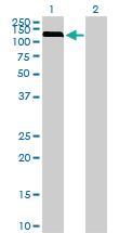 Anti-NEK9 Mouse Monoclonal Antibody [clone: 1F6]