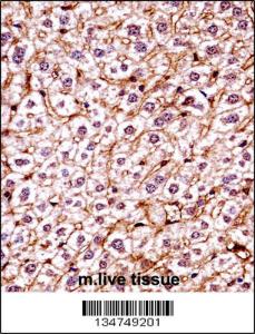 Anti-CSNK1E Rabbit Polyclonal Antibody (AP (Alkaline Phosphatase))