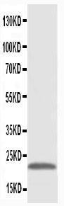 Anti-PMVK Rabbit Polyclonal Antibody