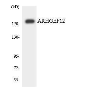 Western blot analysis of the lysates from HUVEC cells using Anti-ARHGEF12 Antibody