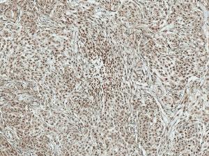 Immunohistochemistry analysis of human brain, fixed in formalin and paraffin-embedded. The Primary Antibody used was Anti-BRSK1 Antibody (A304939) at 1:50 for 30  minutes at room temperature. Counterstain: Hematoxylin. Magnification: 10X