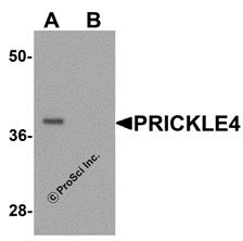 Western blot analysis of PRICKLE4 in A549 cell lysate with PRICKLE4 antibody at 0.25 µg/ml in the (A) absence and (B) presence of blocking peptide.