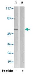 Anti-SGK1 Rabbit Polyclonal Antibody